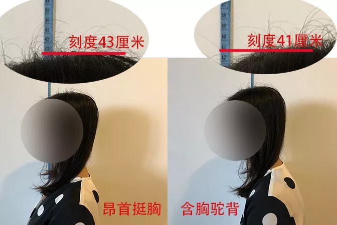 你可能也變得脖子前傾、含胸駝背了